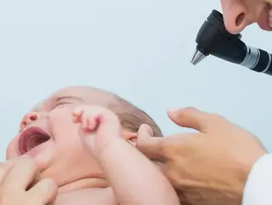 HMOs para la prevención de dermatitis HMOs para la prevención de dermatitis